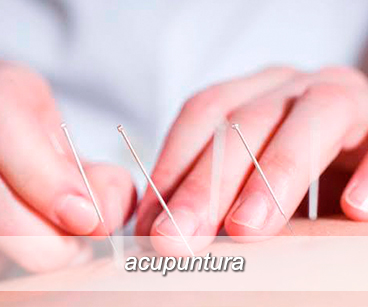 Imagem Ilustrativa acupuntura